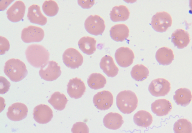 spirochetes.jpg