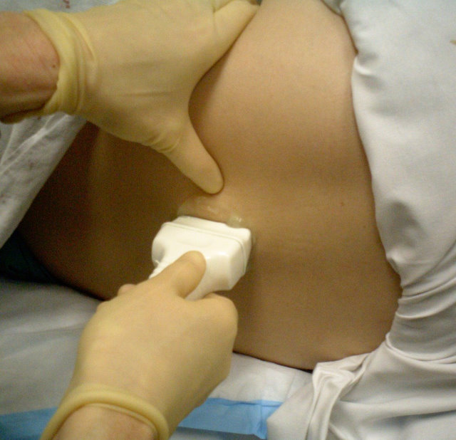 ultrasound-guided-lp1.jpg