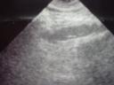 longitudinal-dissection.jpg